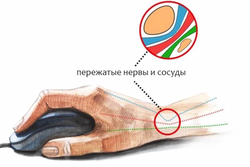 Как зайти в блэкспрут без тора